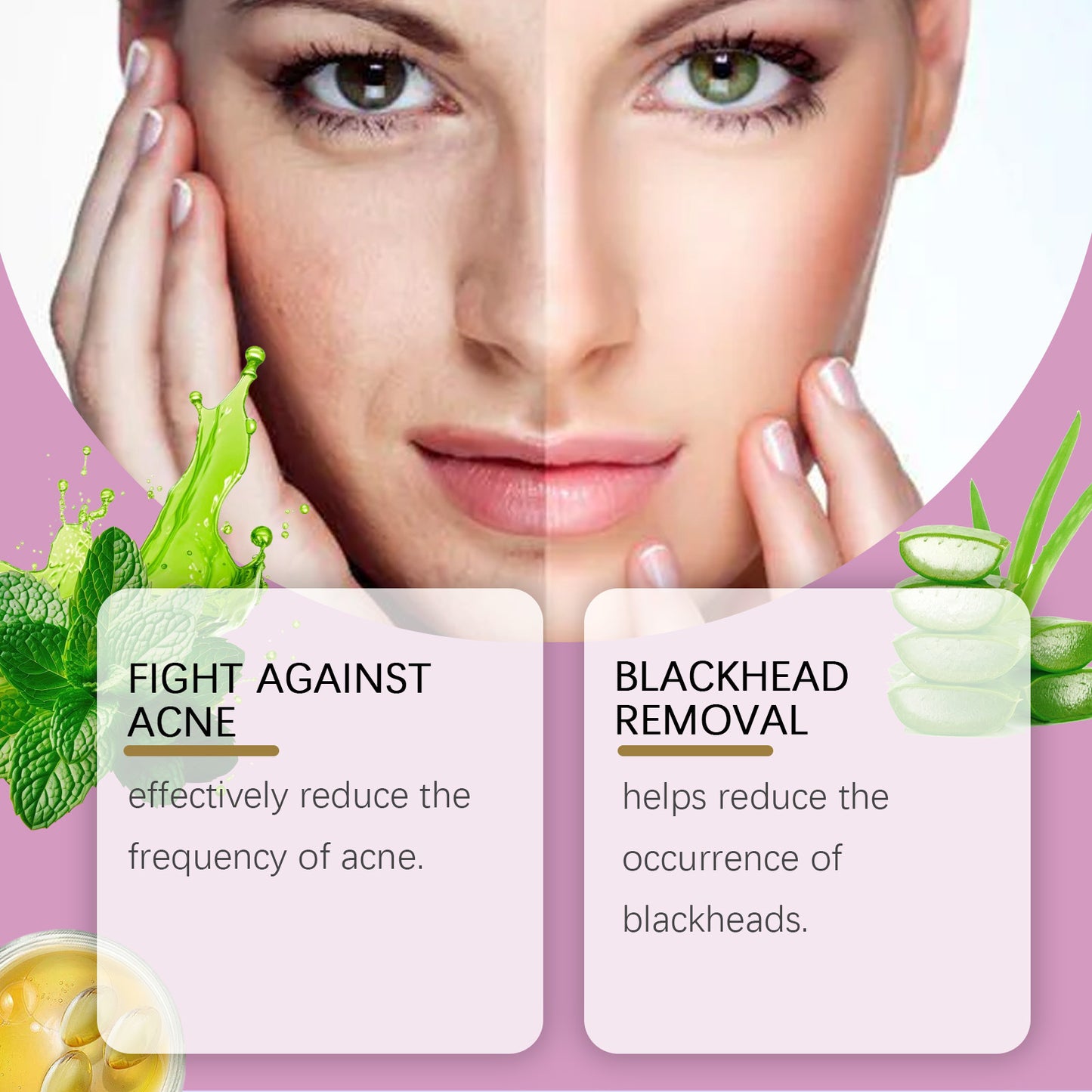 Salicylate Acne Cream