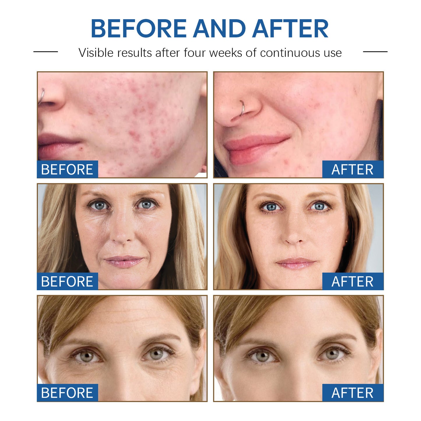 Brightening And Beautifying Skin Discoloration Improvement Deep Hydrating Cream
