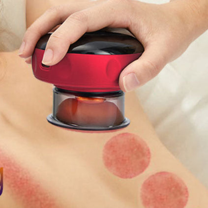 Electric Vacuum Cupping Massage
