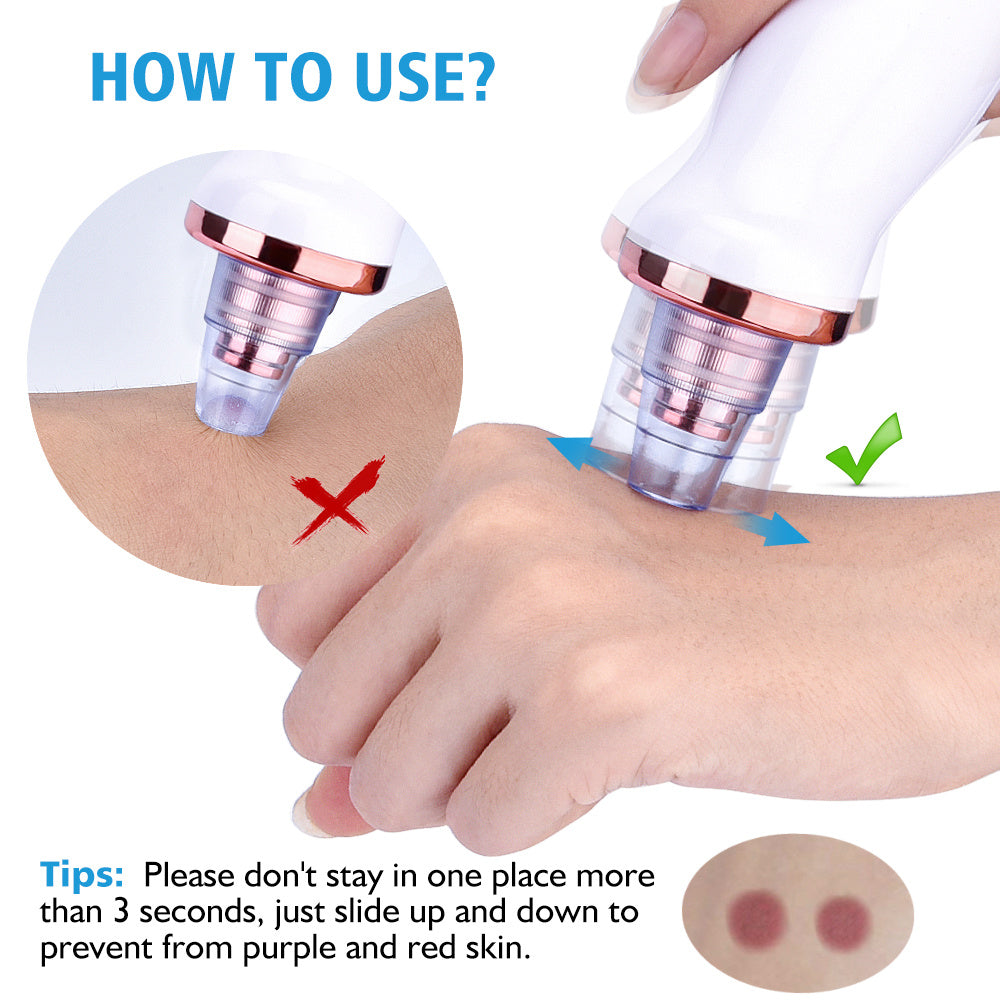Beauty Acne Cleaning Blackhead Suction Instrument