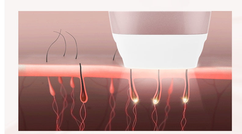 Laser Hair Removal Equipment Photon Skin Rejuvenation